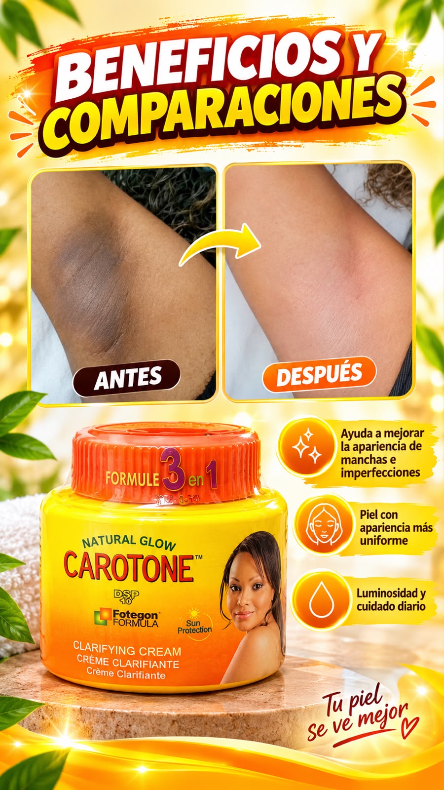 CREMA QUITA MANCHAS EN PIEL CAROTONE